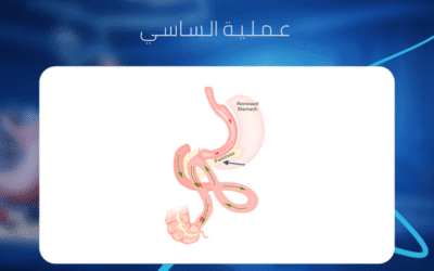 عملية الساسي
